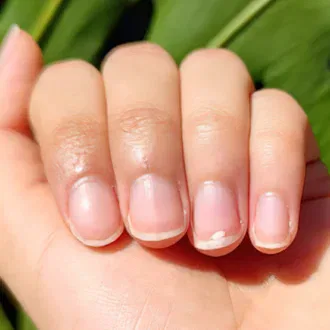 white spots on your nails